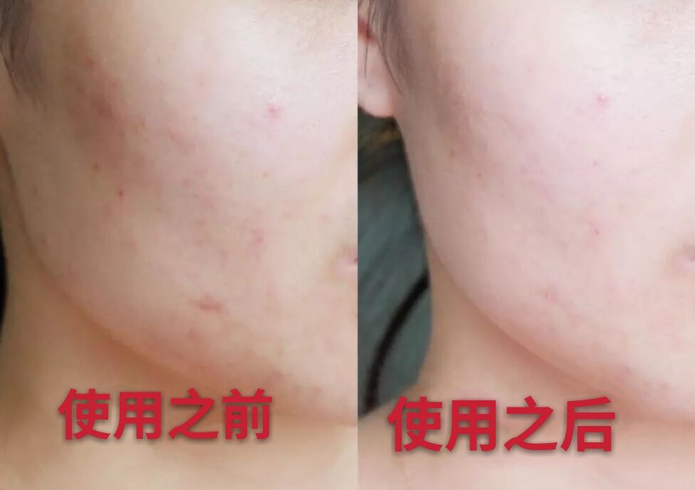 屈臣氏必买面霜,屈臣氏断货王面霜