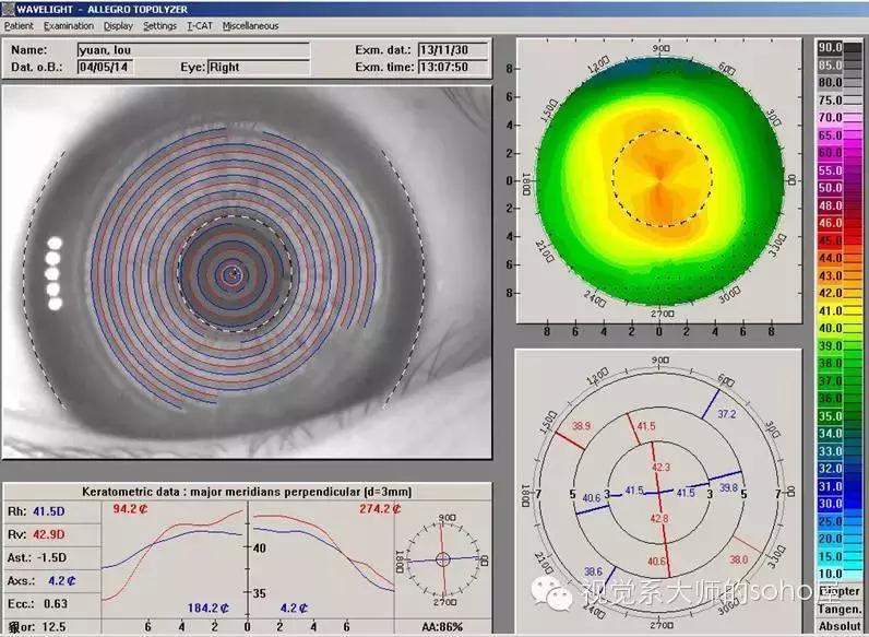如何选择角膜塑形镜的品牌,怎么选角膜塑形镜的参数