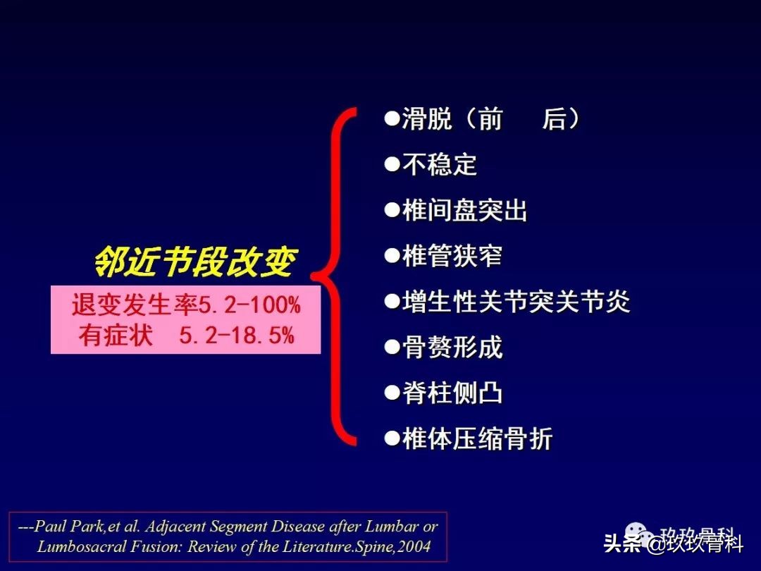 腰椎不稳最坏的结果,腰椎不稳的最佳治疗方法