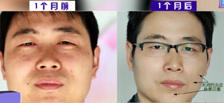 30分钟去黄提亮,变身白美人!皮肤学博士为它强力打call