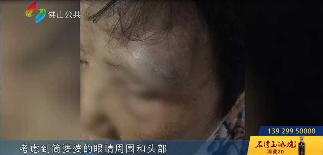 佛山八旬老人在B超室摔出“大包”！女儿大怒：“三个医生在场竟无人扶！”