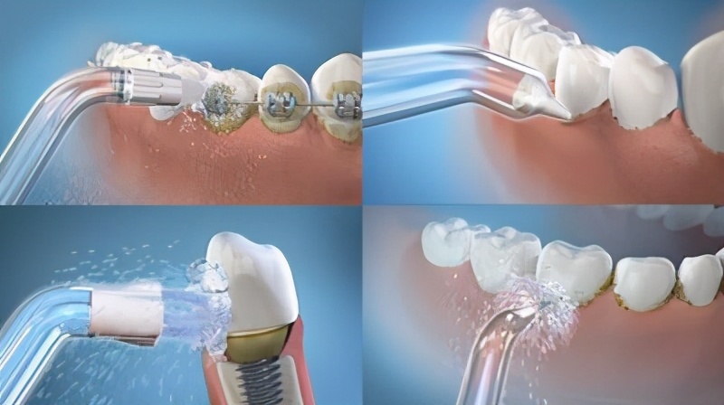 春季唇妆,唇妆不好看