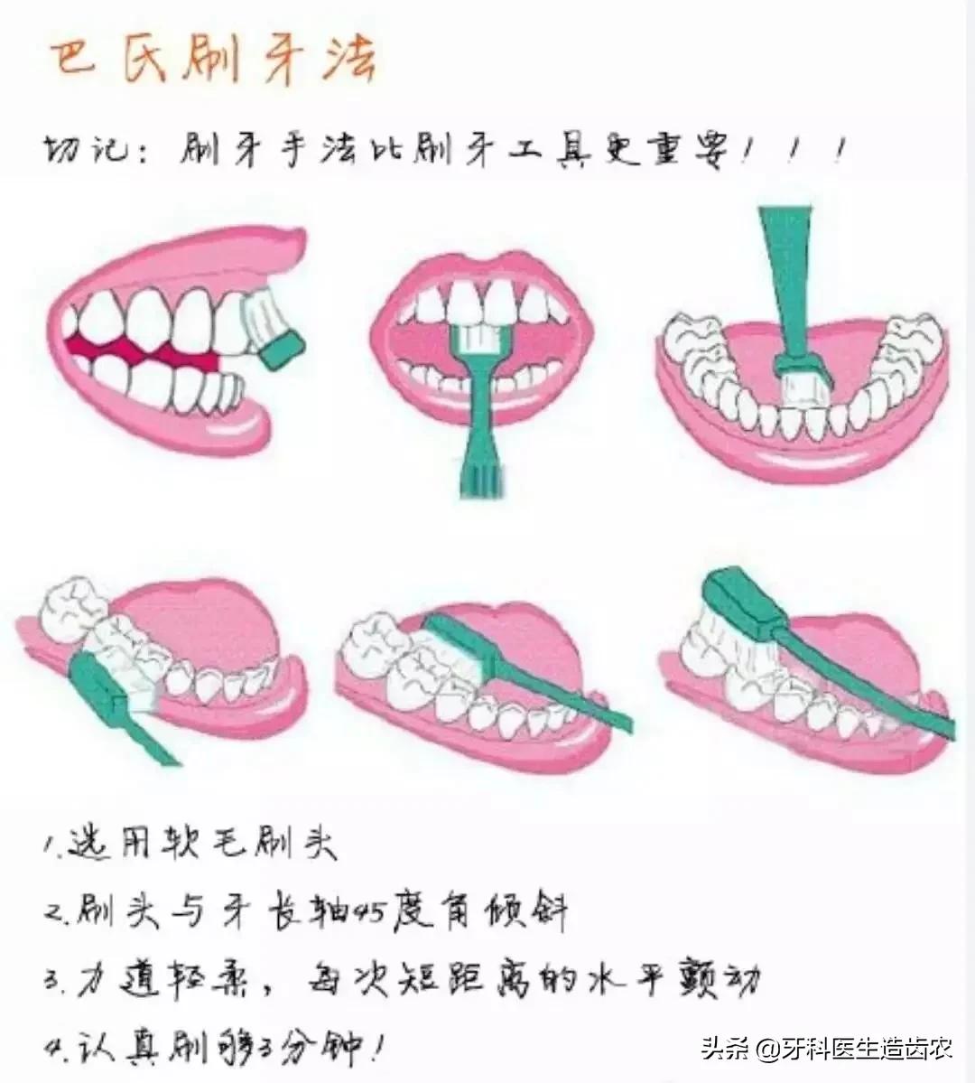 美白牙齿去牙结石电动牙刷,欧乐b电动牙刷可以刷掉牙结石吗