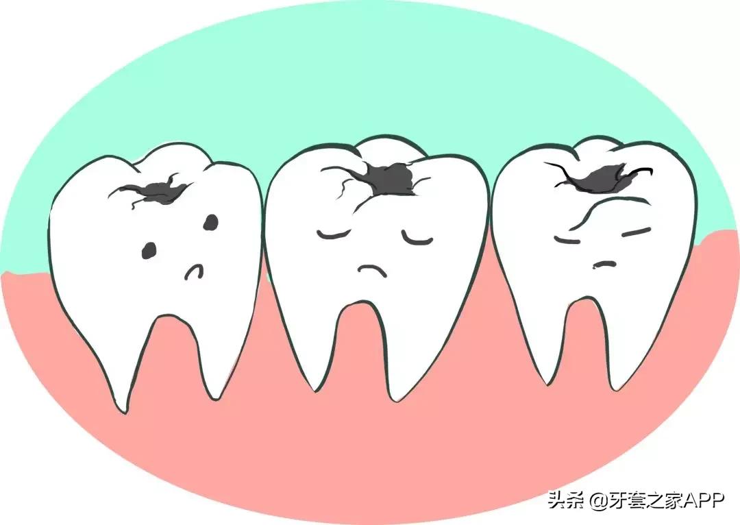 疫情时牙套遇到突发情况怎么办？应对办法在这里