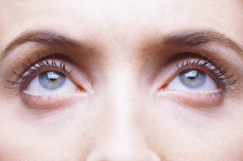 眼袋越来越严重怎样才能改善眼袋,眼袋有皱褶最简单的去眼袋的方法