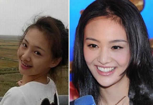 哪些明星整牙后像整容,明星整牙变美了