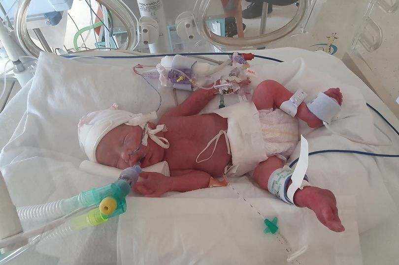 英国孕妇怀孕三胞胎,美国妈妈怀孕羊水破了