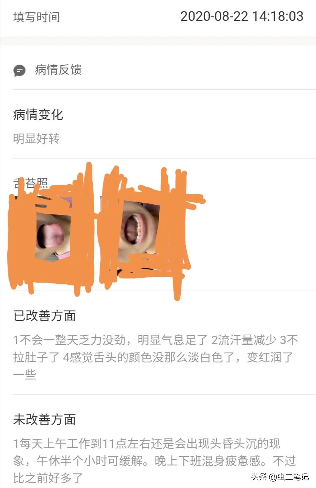 四物汤能治慢性疲劳吗,四物汤的神奇功效