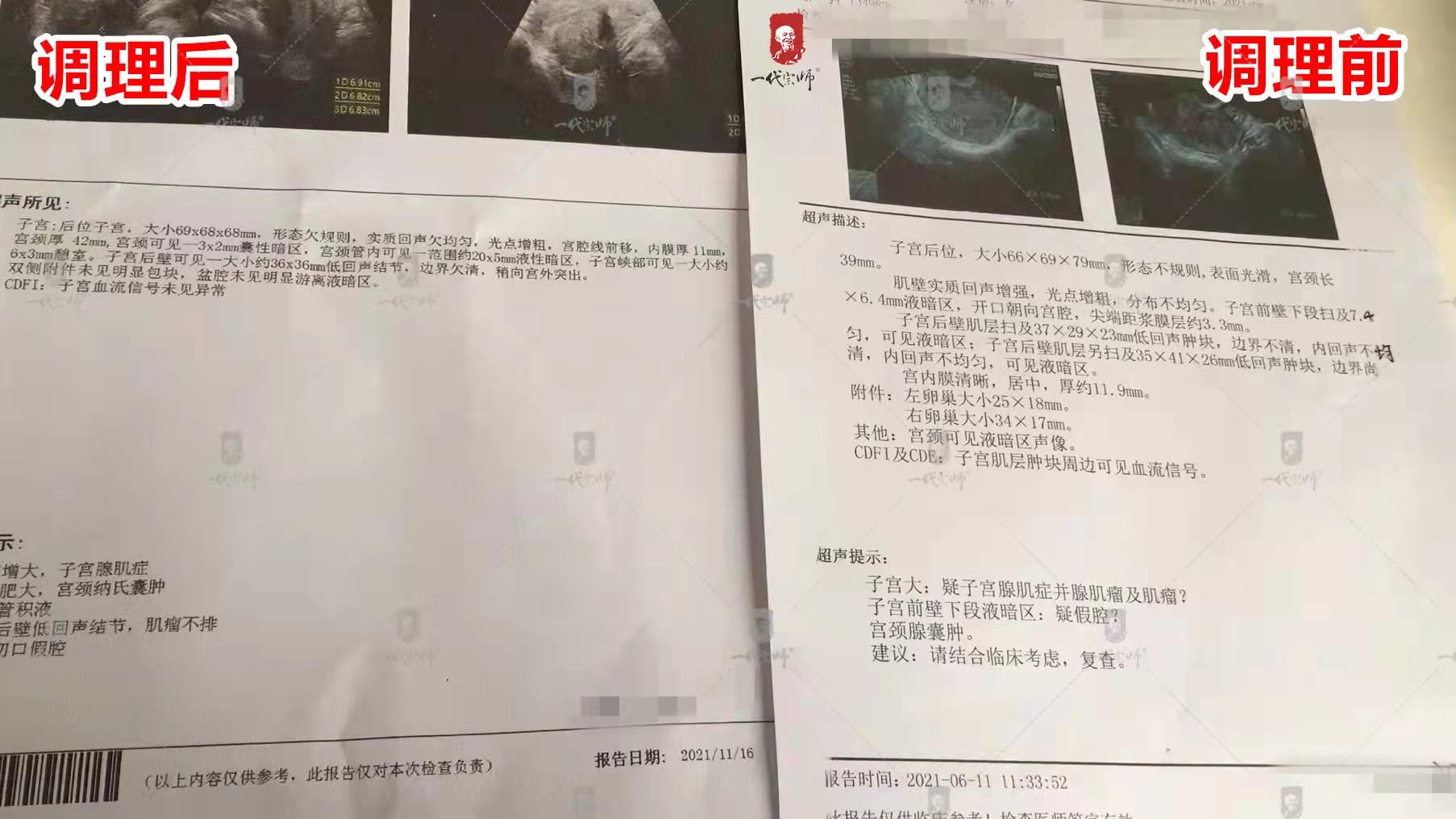 一味中药治妇科疾病,活血化瘀散结却不寒的中药