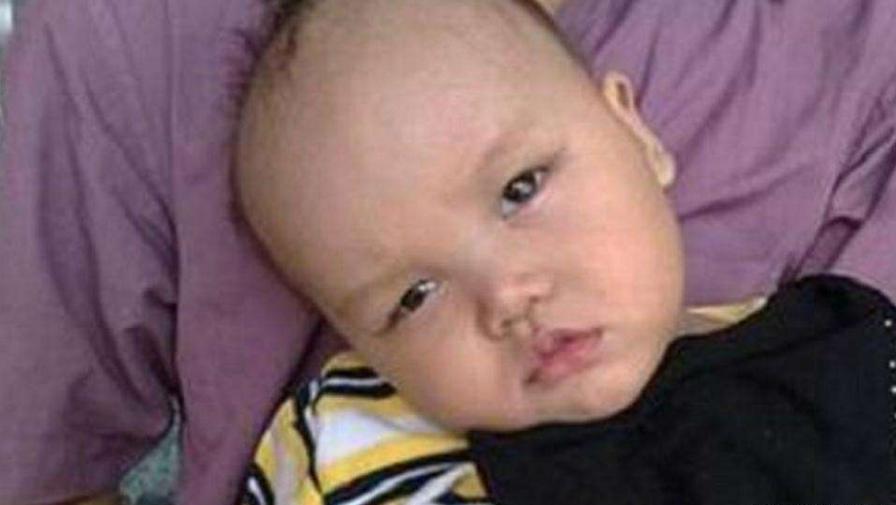 宝宝看手和脑瘫的区别,宝宝开始发育正常后面还会脑瘫吗