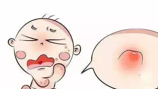 嗡嗡嗡！痒痒痒！招蚊子的宝宝怎么办？夏季驱蚊这样做…