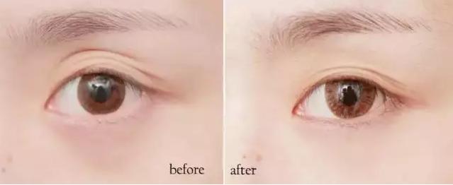 spatreatment紧致抗皱蛇毒眼膜,类蛇毒紧致修复眼膜