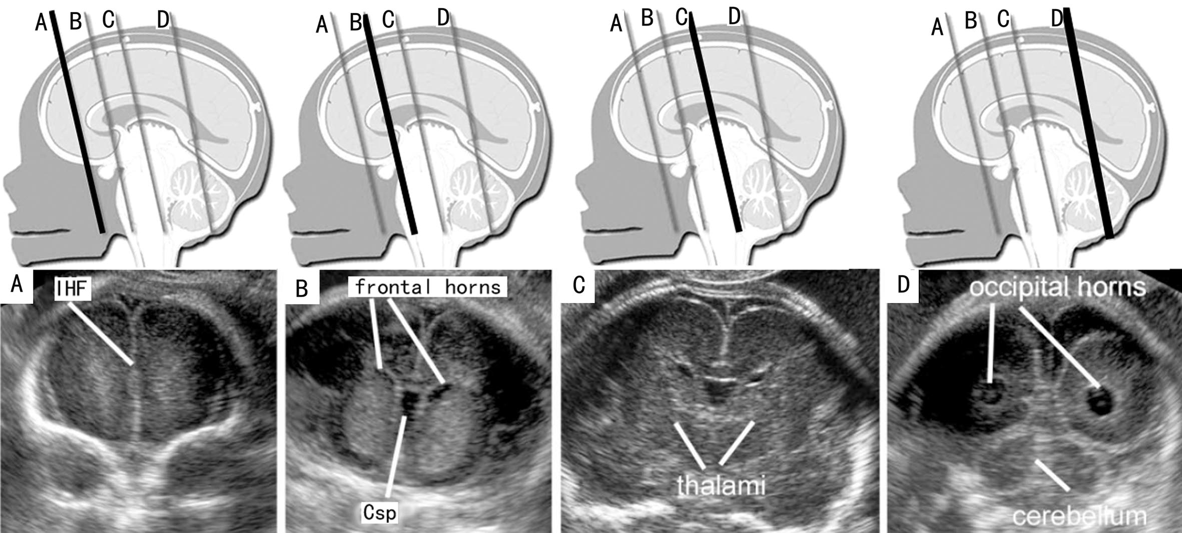 做彩超是不是能清楚看见胎儿,做彩超胎儿仰面平躺