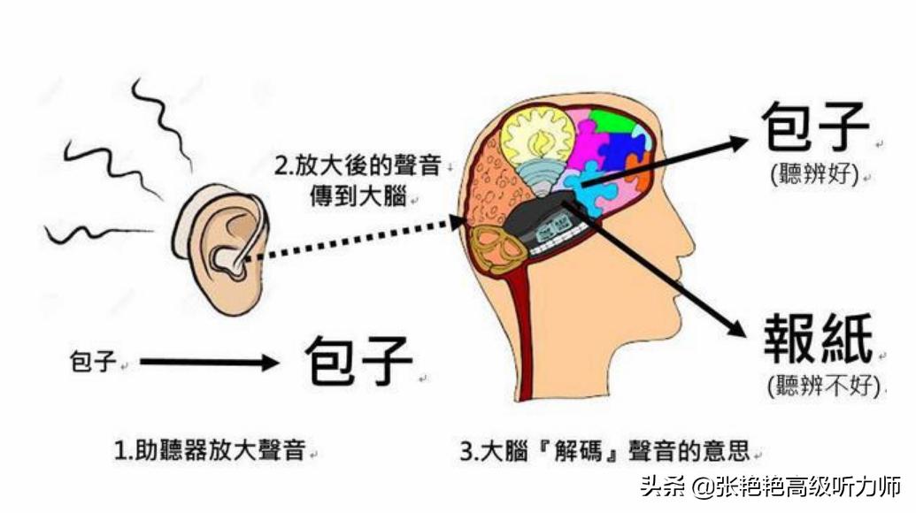 听力辟谣,轻度耳聋戴助听器有用吗