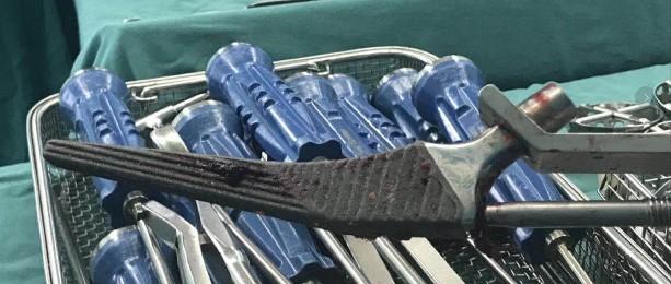 髋部骨折危害大老年人摔伤要重视,髋部骨折的最简单方法