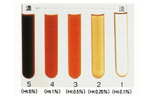 体检发现尿潜血怎么办？别担心，三步帮你解决问题！