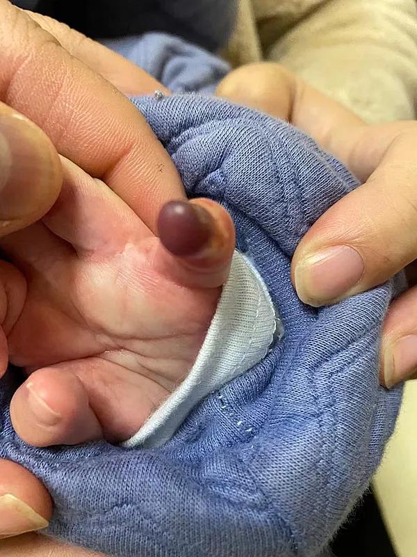 妈妈防止宝宝抓脸面具,出生婴儿防抓脸