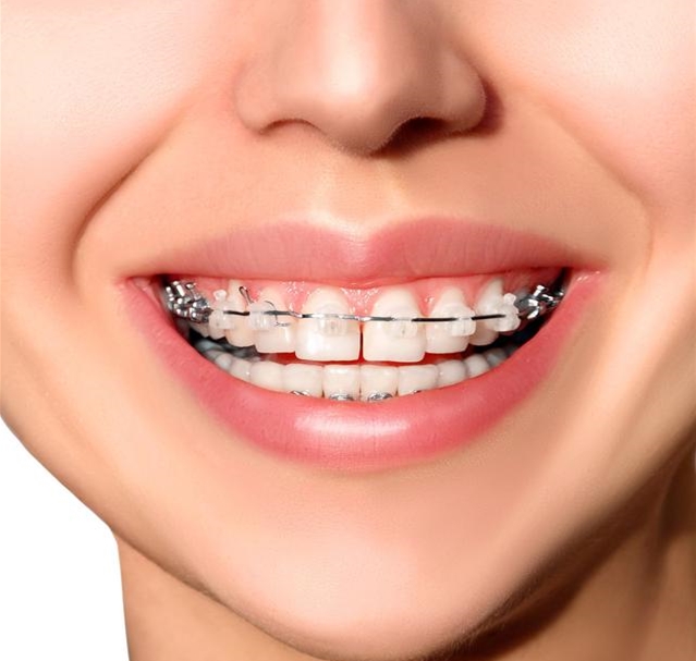 可怕的牙齿治疗,可怕的牙齿蛀牙