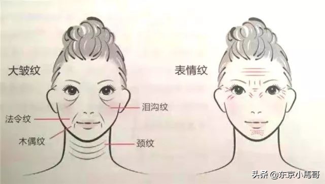 pola抗皱精华能减轻法令纹吗 (pola去皱精华限定套装)