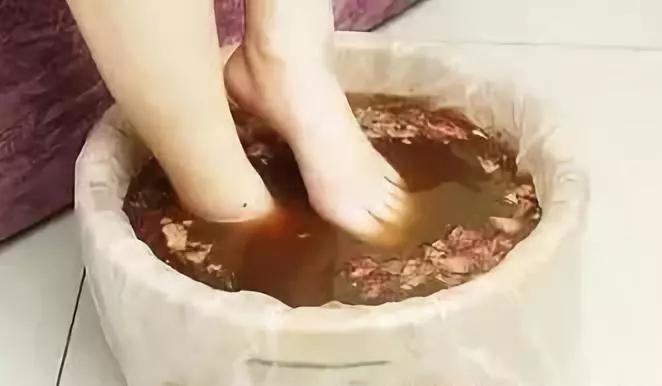 骨伤科熏洗的注意事项,骨伤用药有哪些