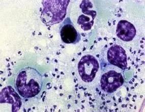 关于新型冠状病毒的知识和真相,我们要如何判断新型冠状病毒感染