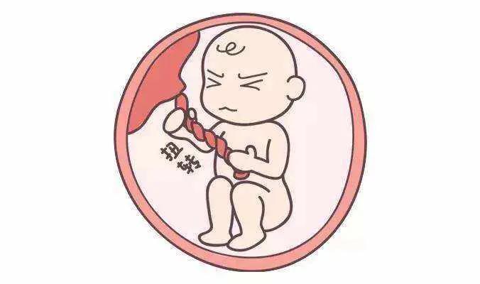 35周脐带绕颈一周,孕期脐带绕颈怎么办