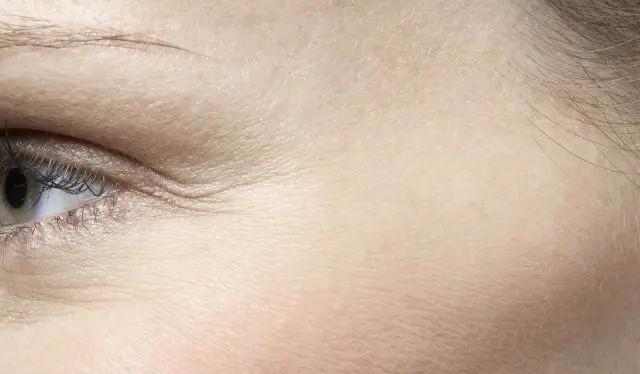 去鱼尾纹最简单的方法是哪种,名门泽佳怎么去黑眼圈