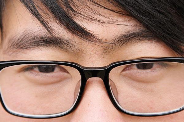 眼袋做完了眼部皮肤会不会松弛,眼袋松是什么原因导致的