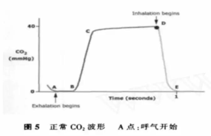 李娟教授：呼气末二氧化碳分压监测的临床应用