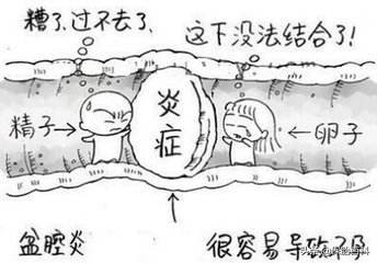 久坐对女性盆腔的影响,上班经常久坐如何预防疾病