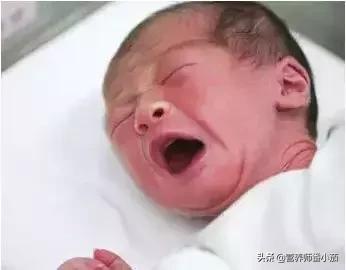 粟粒疹宝宝,宝宝红斑丘疹鉴别图谱