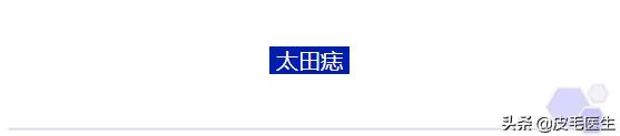 褐斑祛斑最有效方法,年轻人脸上长褐斑老年斑如何治疗