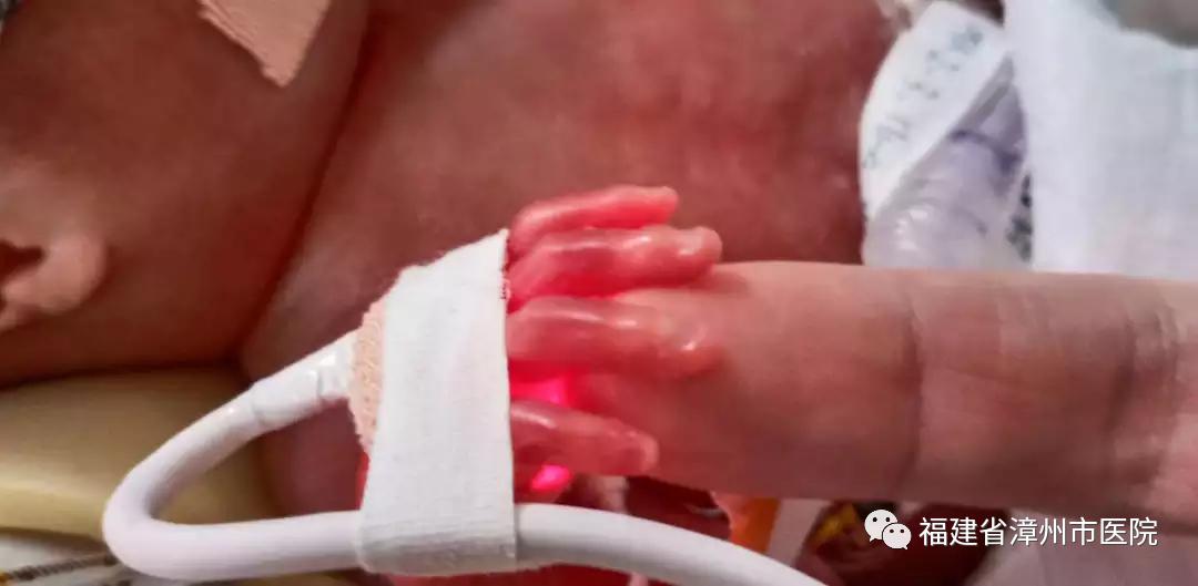 砺剑三载展风华——漳州市医院龙文院区打造妇幼医疗新标杆