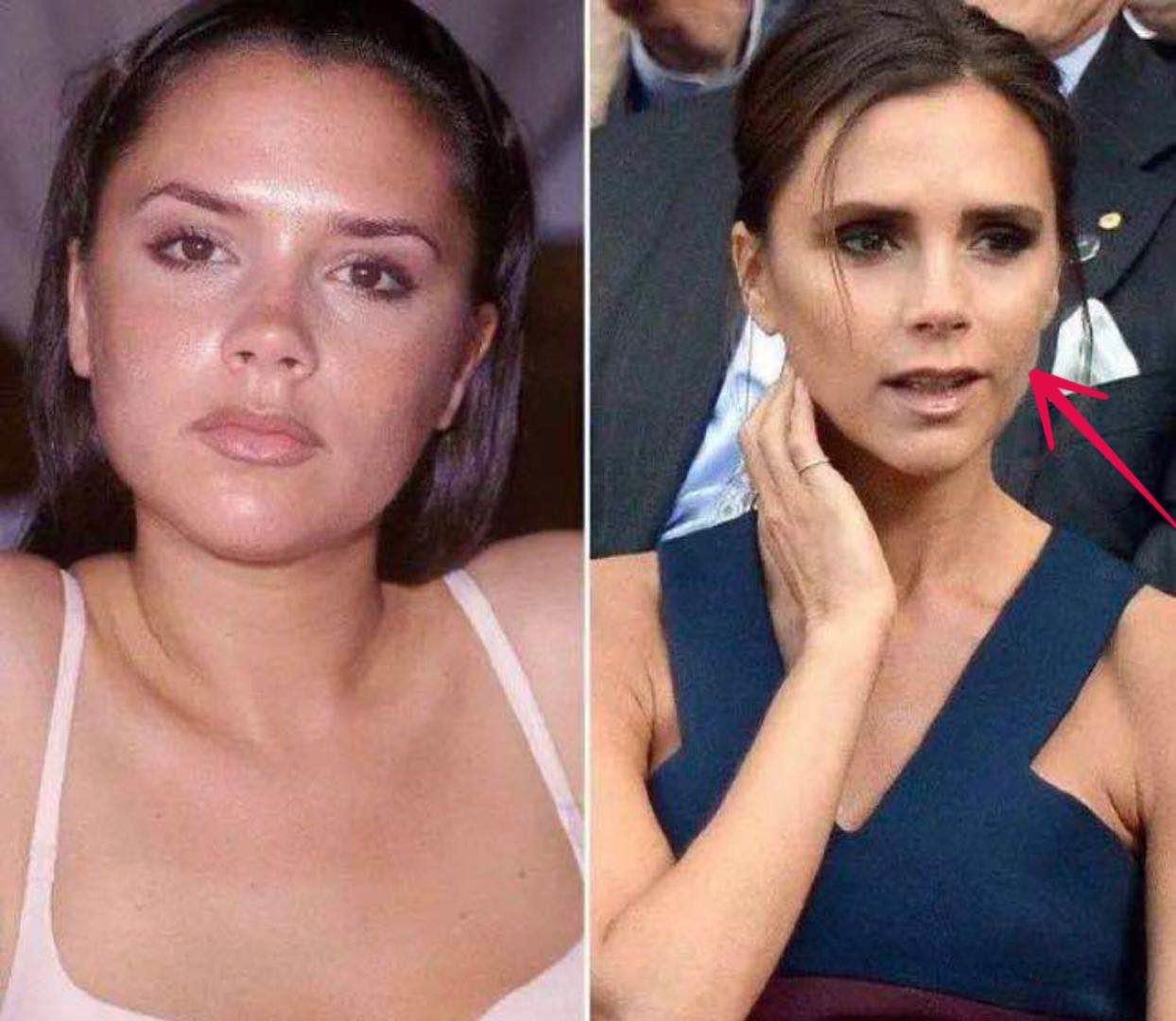 贝嫂维多利亚整鼻子了吗,贝嫂维多利亚化妆视频