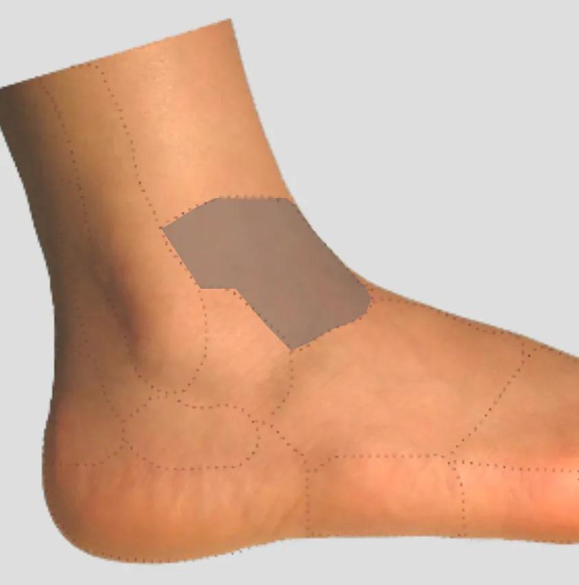 足踝各种疼痛的原因,足踝内侧疼痛自测