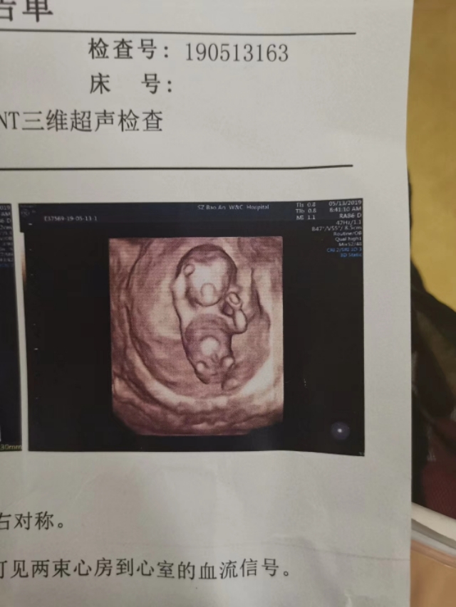 我的孕期记录表,我的孕期记录双胞胎