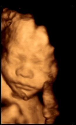 37周做四维彩超有必要吗,孕期四维彩超有必要做吗