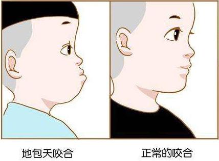 小孩子牙齿不齐多少岁矫正比较好,孩子牙齿不齐什么年龄矫正最合适