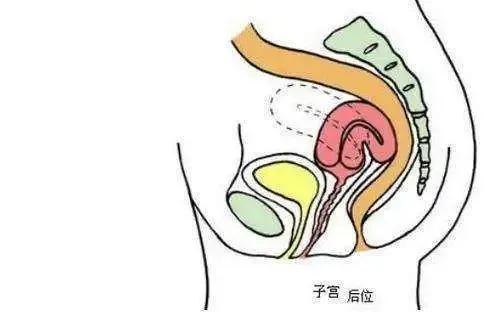 子宫后位会影响胚胎移植效果吗,孕妇子宫后位会难产吗