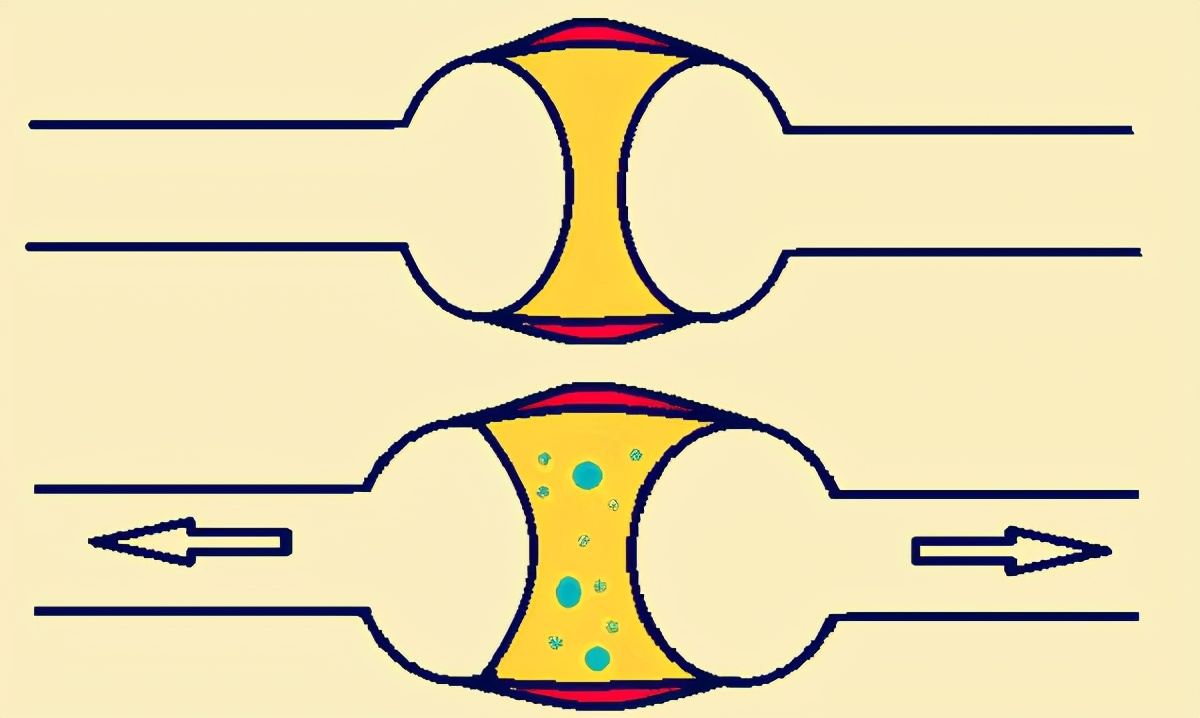 膝关节弹响的原因及治疗方法,膝关节有弹响隐隐作痛吃什么药