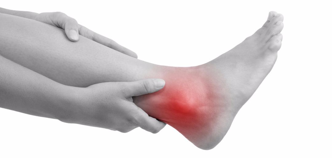 掌指关节扭伤处理方法,脚扭伤健康科普总结