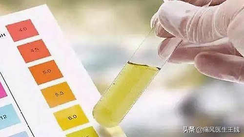 关于尿酸性肾结石的发生与预防,你了解多少?