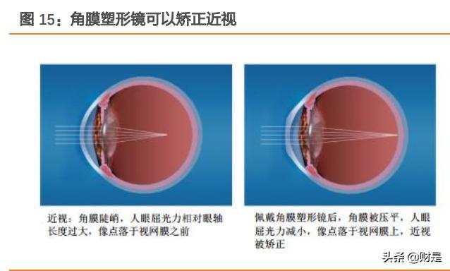 爱博医疗研报,爱博医疗最新资讯