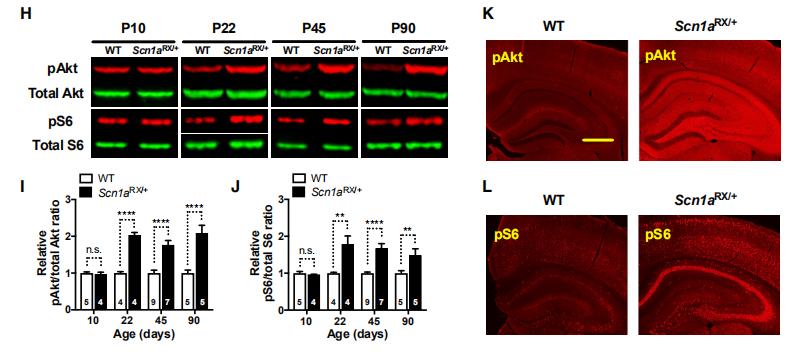 重磅研究成果!科学家在小鼠模型中发现改善自闭症核心症状新方法