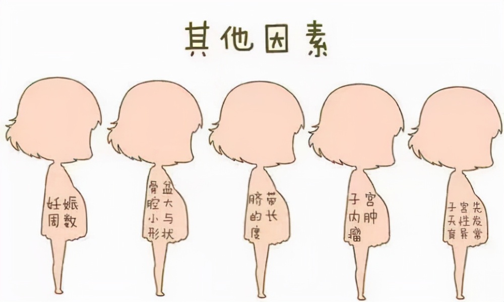 孕期胎位不正怎么办？别担心，除了纠正还有其他办法可以解决