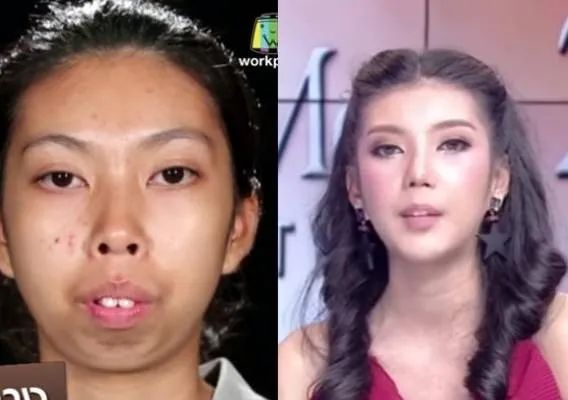 泰国最逆天的不是变性，而是堪比换头的整形