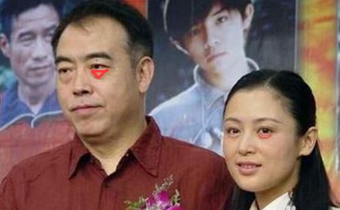 眼袋和卧蚕的区别教你区分小妙招,眼袋和卧蚕的区别在哪里