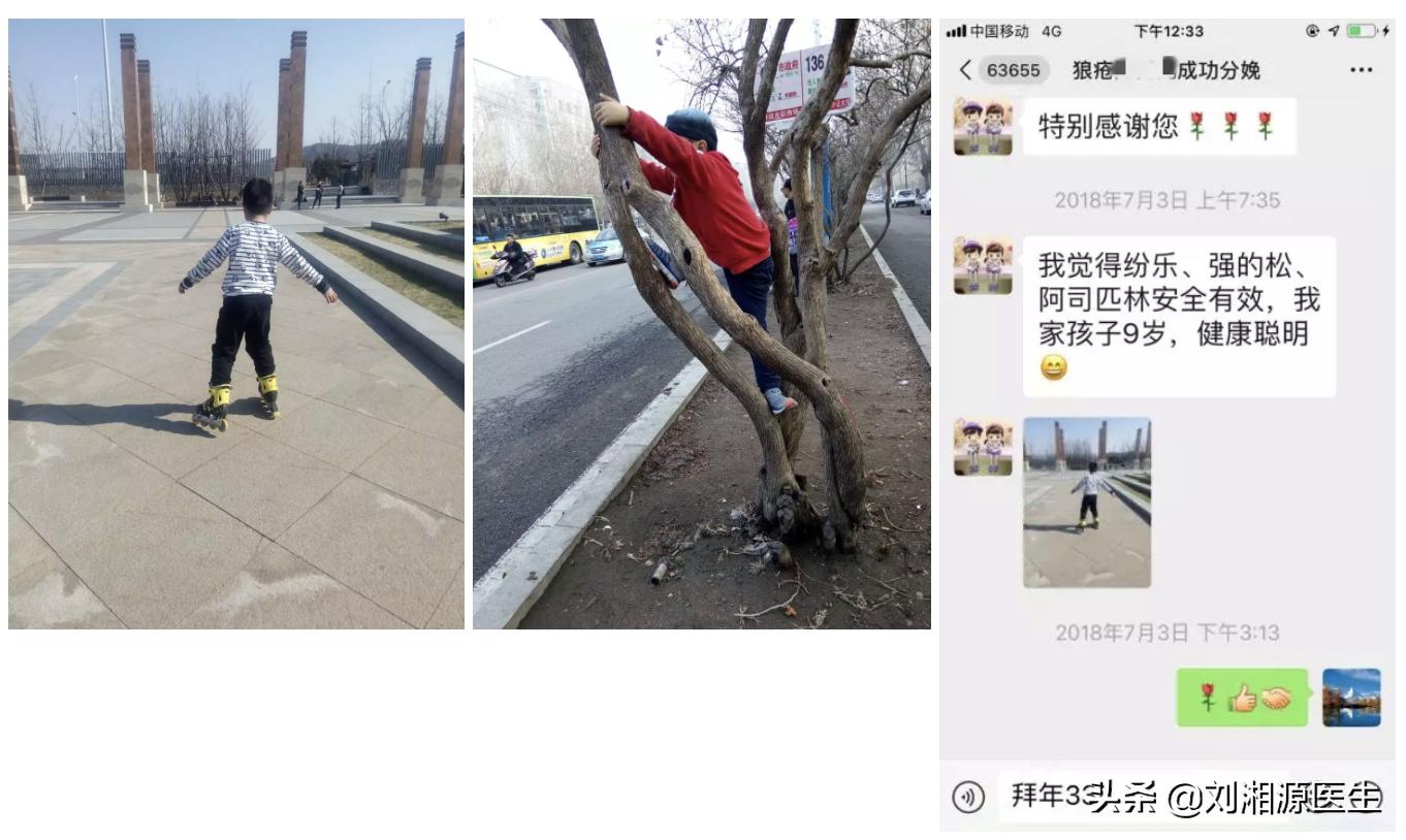 狼疮合并抗磷脂综合症积极治疗后,生下健康宝宝,生二胎则是奢望