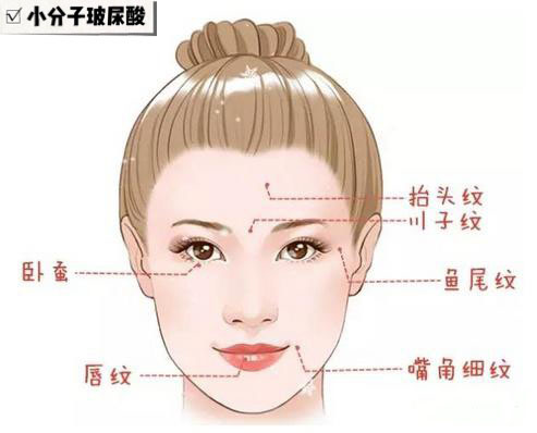 避坑玻尿酸精华,玻尿酸品牌该如何选择