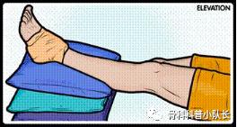 刚崴脚是要冷敷还是热敷,崴脚后24小时内是热敷还是冷敷